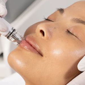 Deluxe HydroFacial